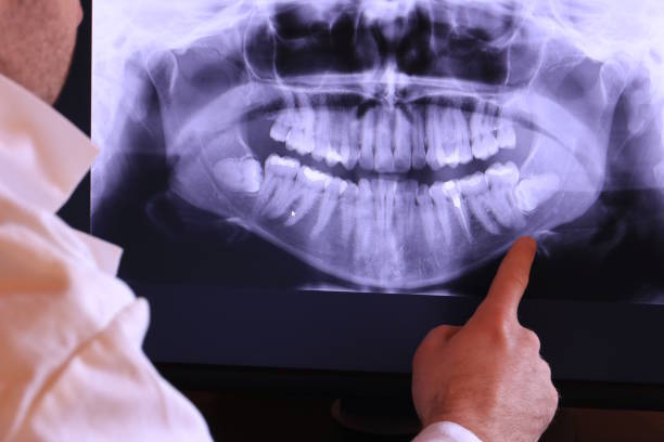 Best Cracked Tooth Emergency Dentist  in West Berlin, NJ